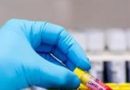 Novo vírus zoonótico encontrado na China, 35 casos conhecidos de infecção: Estudo |  Noticias do mundo