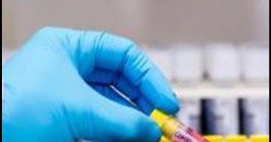 Novo vírus zoonótico encontrado na China, 35 casos conhecidos de infecção: Estudo |  Noticias do mundo
