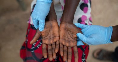 OMS usará ‘mpox’ para designar a varíola dos macacos |  Noticias do mundo