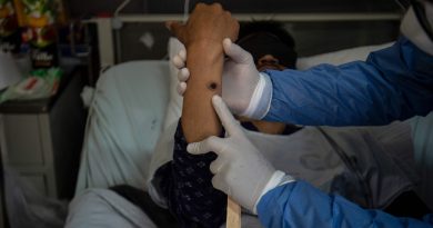 Planos dos EUA encerram emergência de saúde pública por mpox em janeiro |  Noticias do mundo